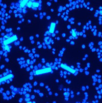 Immunomodulatory biomaterials